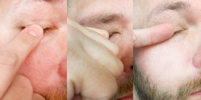 Fingertip Knuckle Fingernail eye rubbing