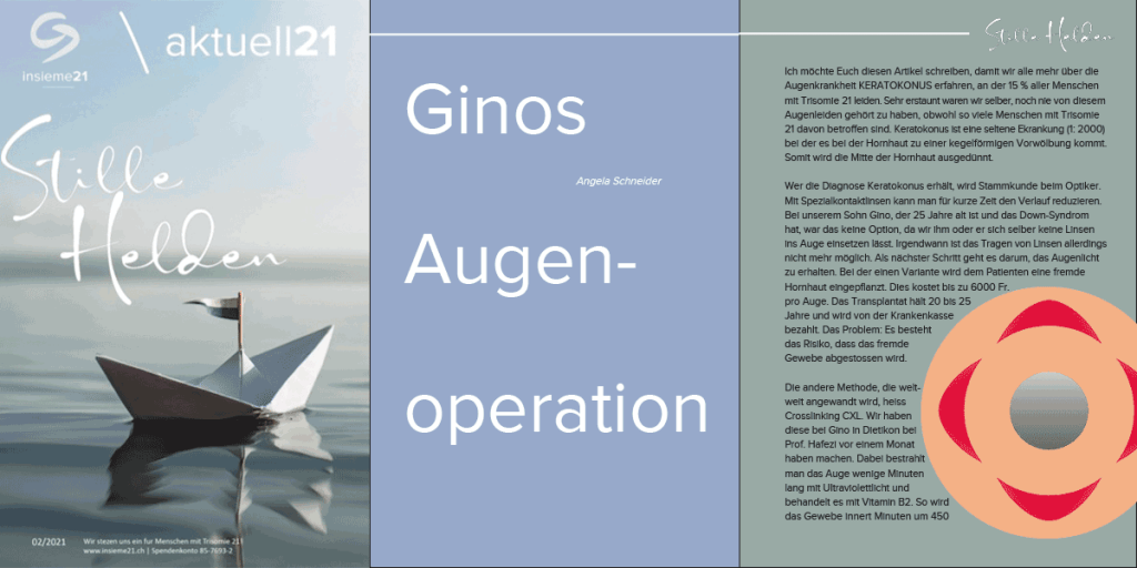 Gino's eye operation - Insieme21