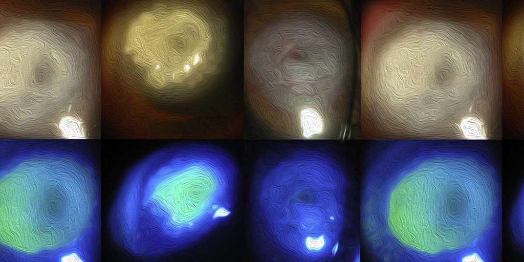 High fluence PACK-CXL