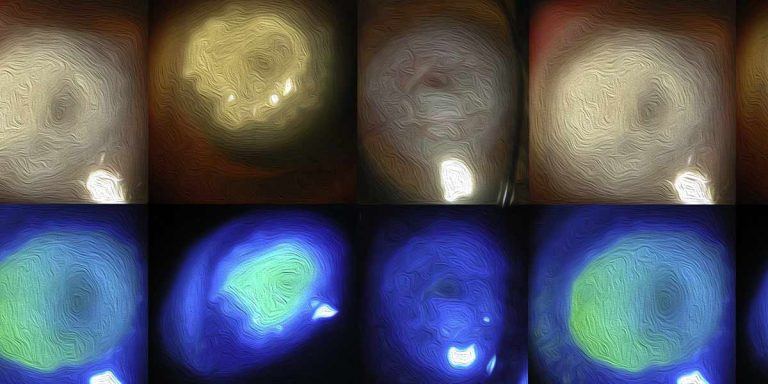 High fluence PACK-CXL