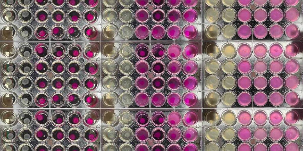 corneal-enzymatic-digestion-featured-image showing petri dishes with corneal buttons being digested by collagenases
