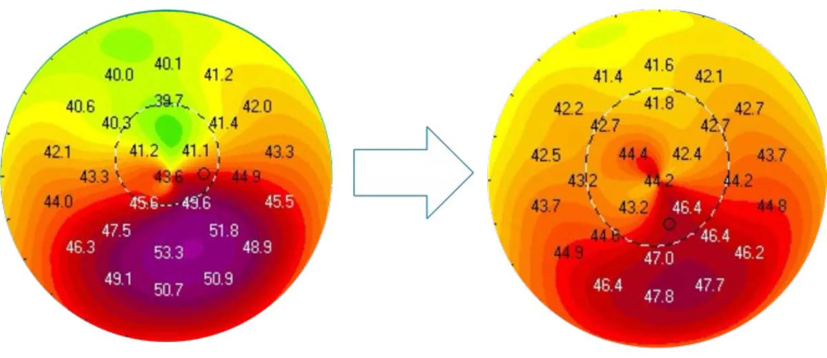 Before CXL -> After CXL