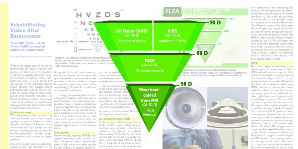 ELZA rehabiliating keratoconus