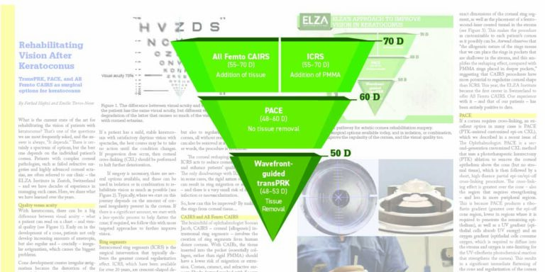 ELZA rehabiliating keratoconus