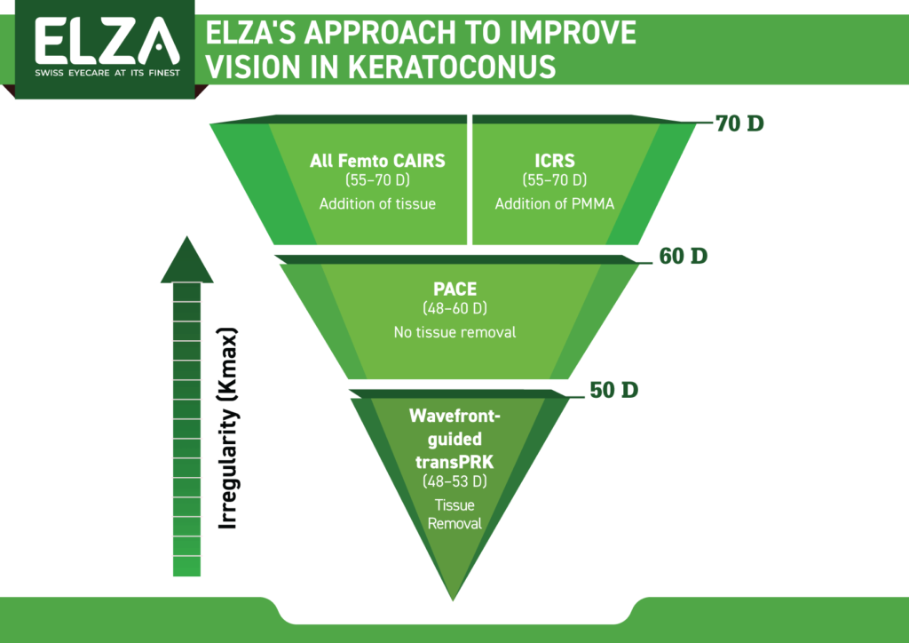ELZA Approach to rehabilitating keratoconus vision