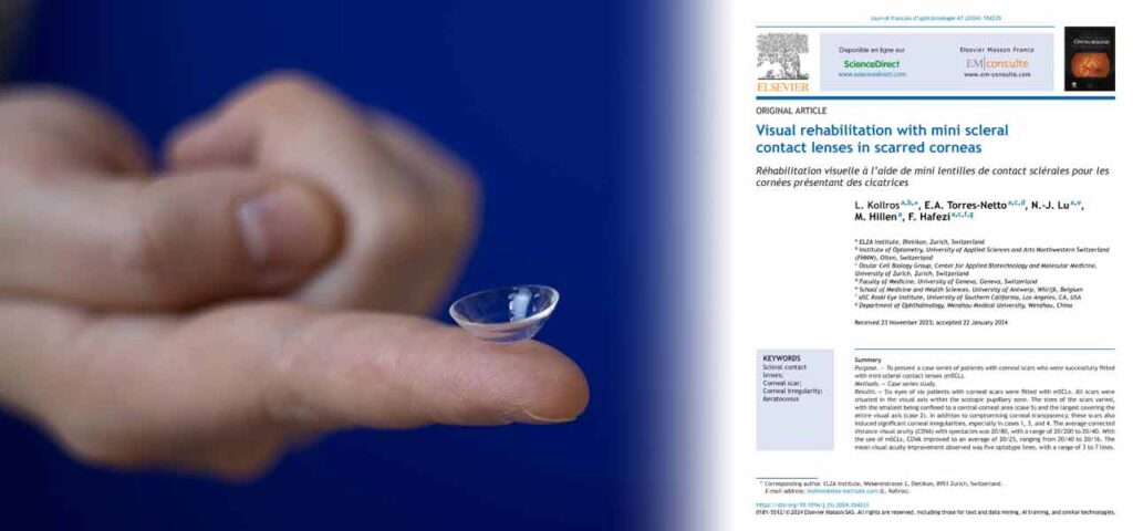 Mini scleral contact lens on Léonard Kollros' finger