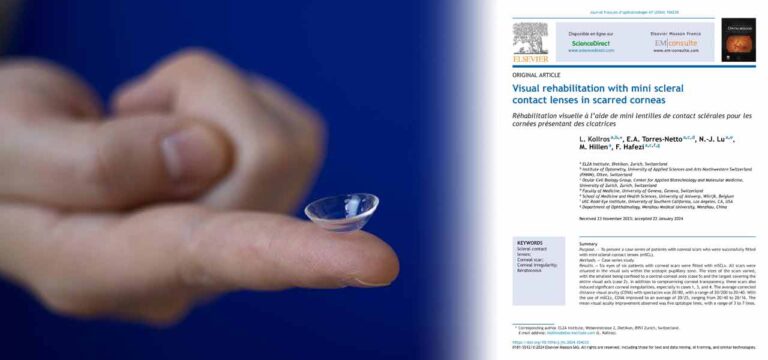 Mini scleral contact lens on Léonard Kollros' finger