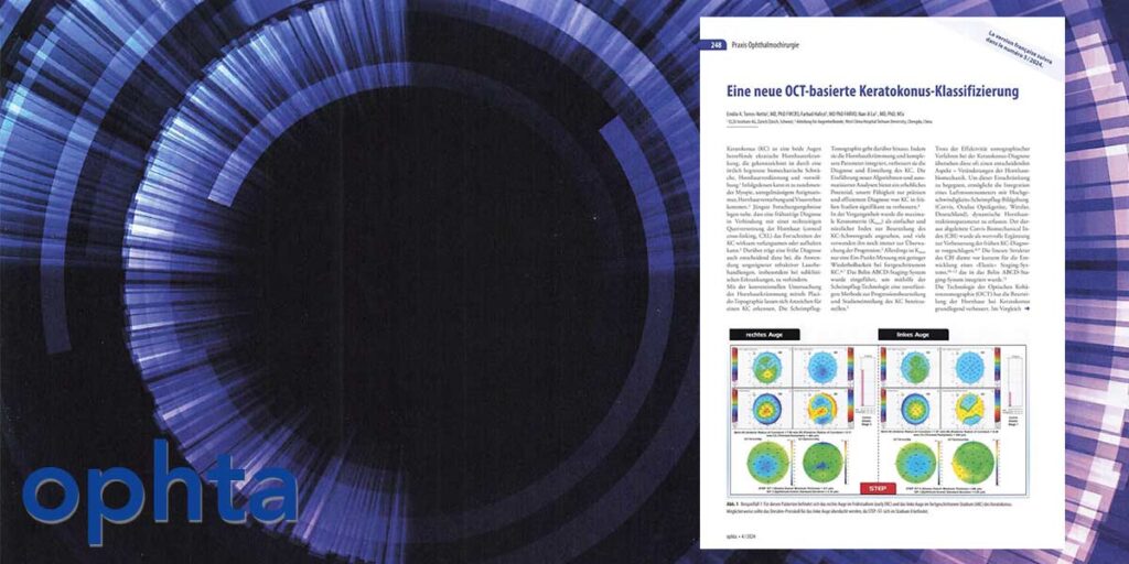 OCT keratoconus classification featured image ophta