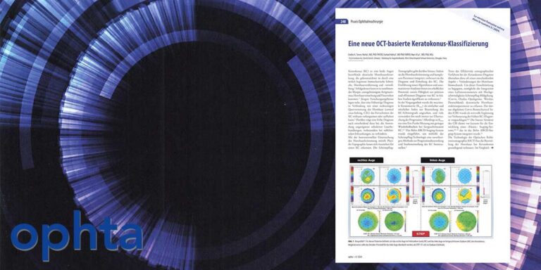 OCT keratoconus classification featured image ophta