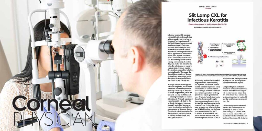 Slit-Lamp CXL for infectious keratitis treatment