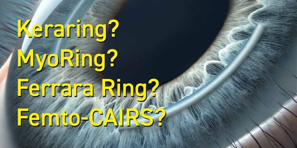 Keraring? MyoRing? Ferrara-Ring? Femto-CAIRS? Was sind die ICRS-Unterschiede?