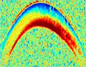 OCT-elastography-image