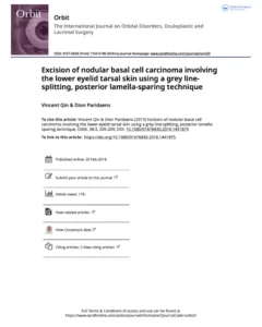 Excision-nodular-basal-cell-carcinoma